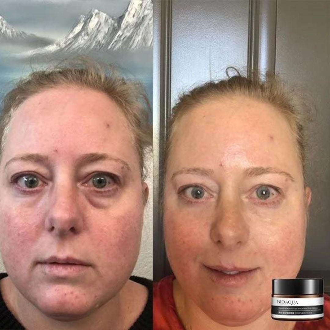 Crema Anti-Edad Bioaqua®