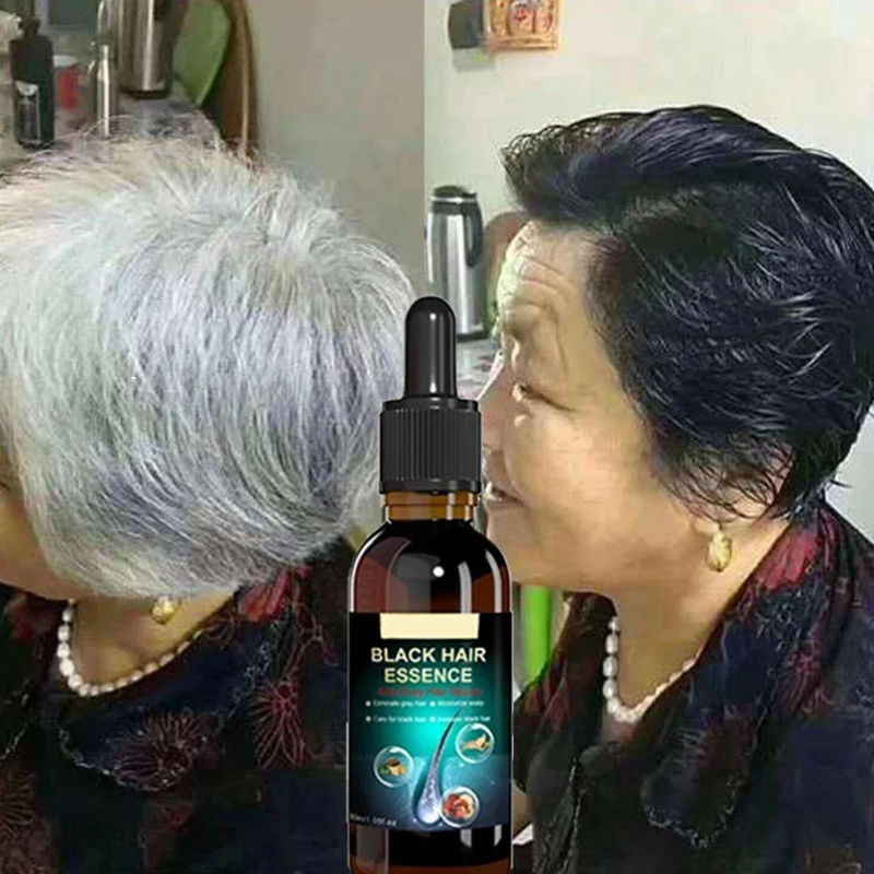 Esencia Capilar Black – Tratamiento Anticanas