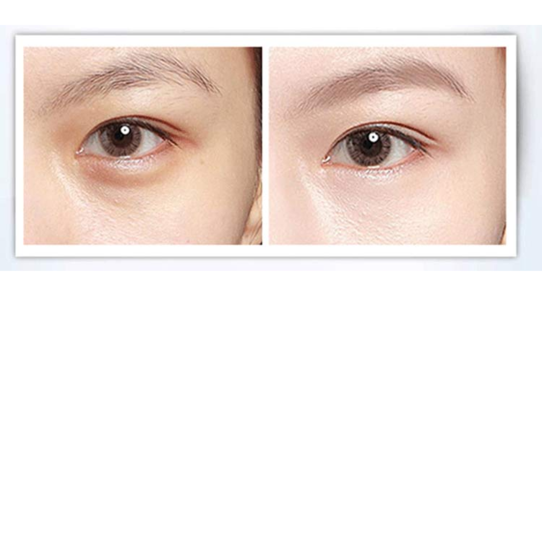 Crema Despigmentante para Ojeras Psiuan