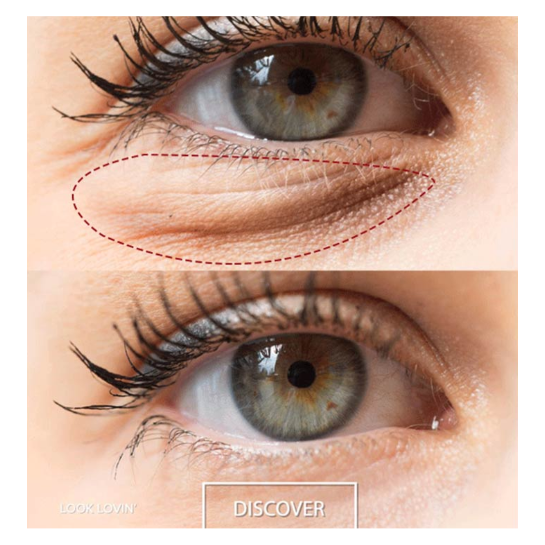 Crema Despigmentante para Ojeras Psiuan