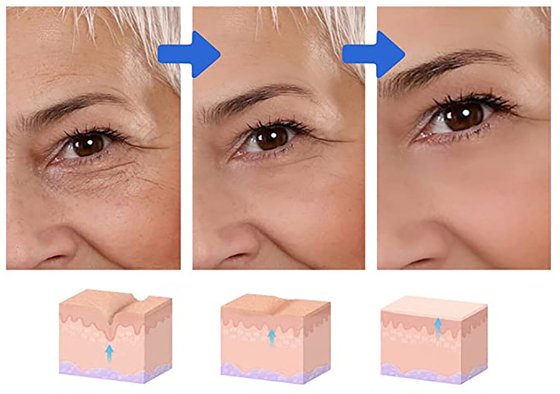 Crema Despigmentante para Ojeras Psiuan