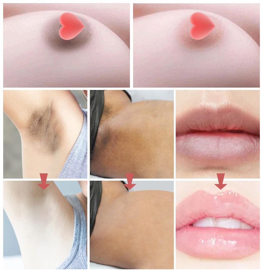 Crema Aclarante Íntima Pink